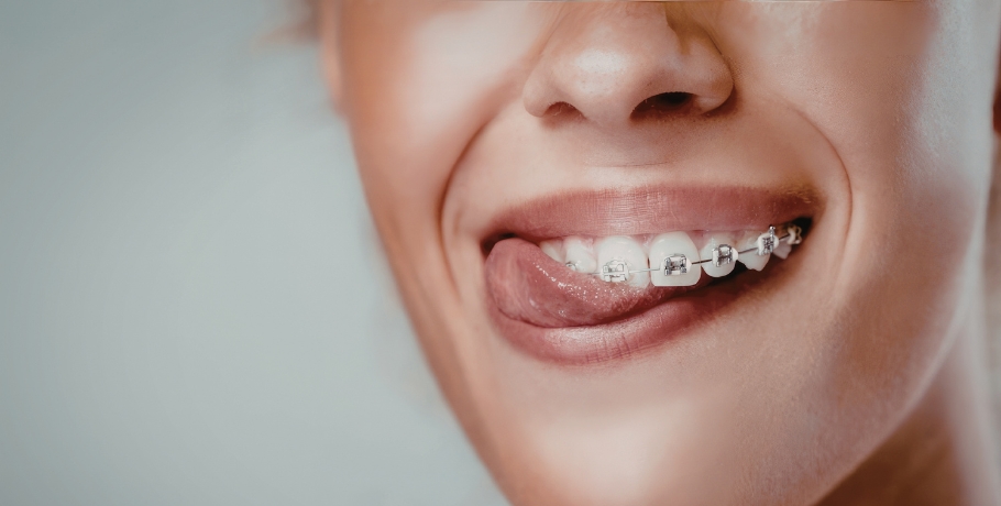 Herpes: Symptome, Ansteckung und was gegen Ausbr�c�bcrche helfen kann