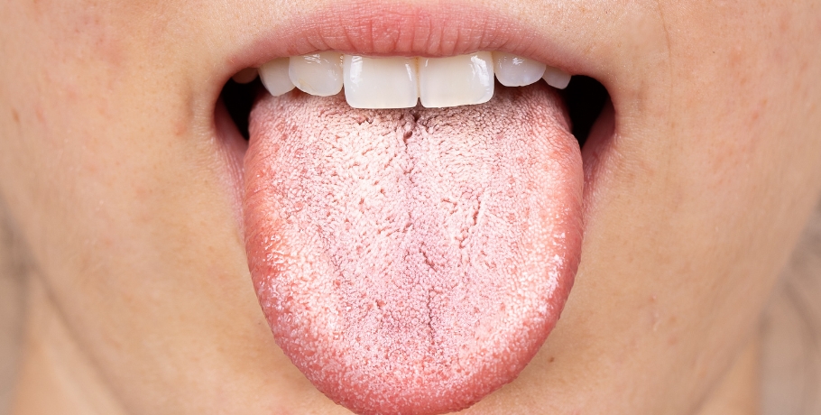 Welche Symptome treten bei einer Überwucherung von Candida oder anderen Pilzen auf? Welche Symptome treten bei einer Überwucherung von Candida oder anderen Pilzen auf?